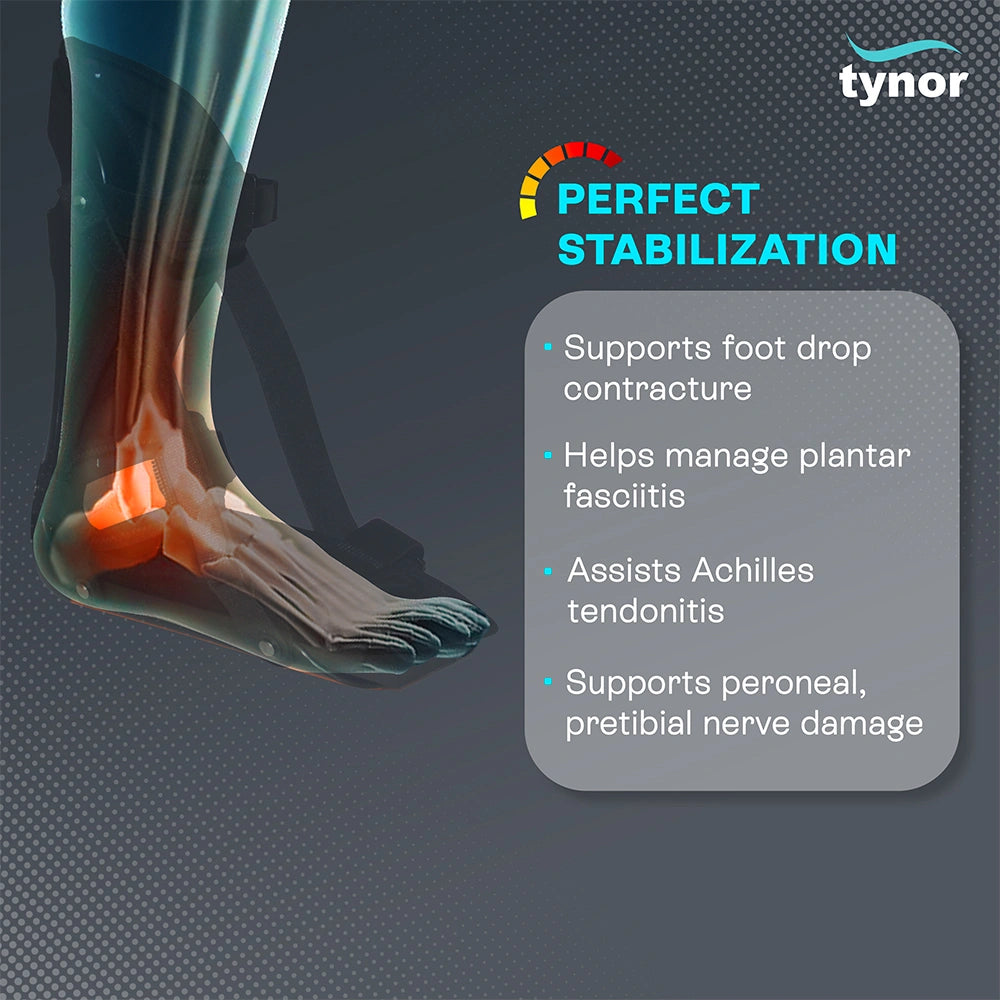 PF Night Splint Derotation