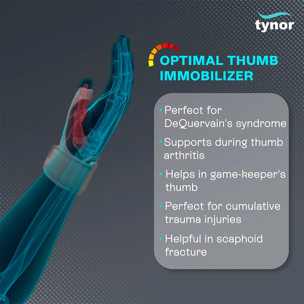 Thumb Spica Splint