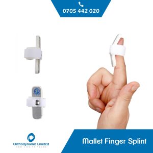 Mallet Finger Splint