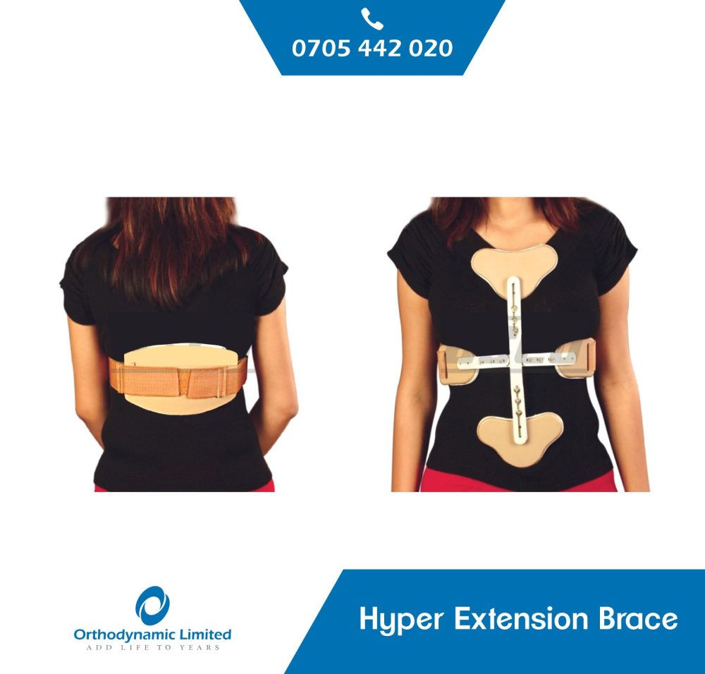hyper-extension-brace.jpeg